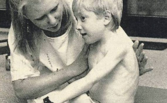 Physiotherapie und Mukoviszidose damals Schütte